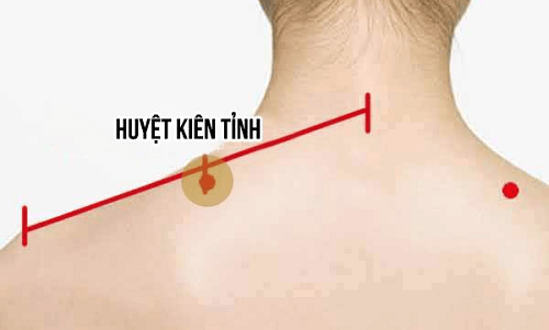 cach-bam-huyet-kien-tinh