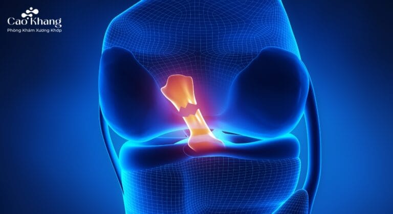 chấn thương dây chằng