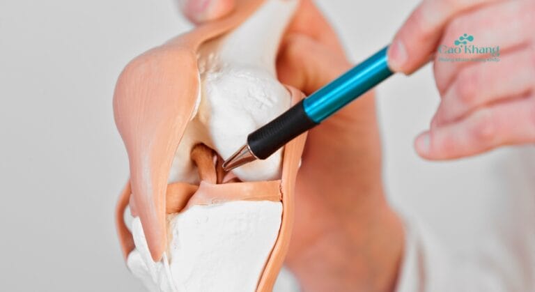 dây chằng là gì