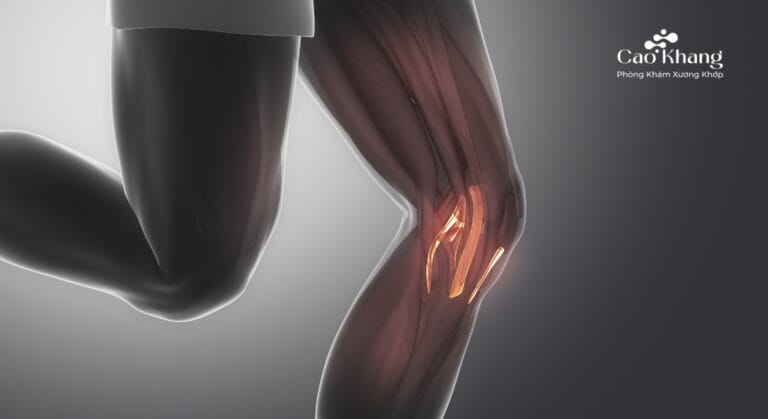 đứt dây chằng chéo sau