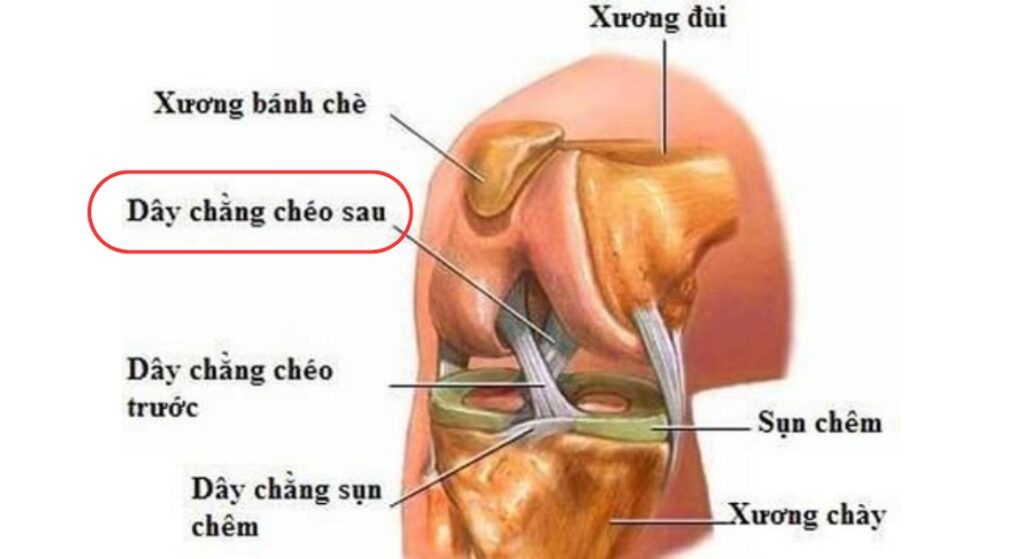 đứt dây chằng chéo sau