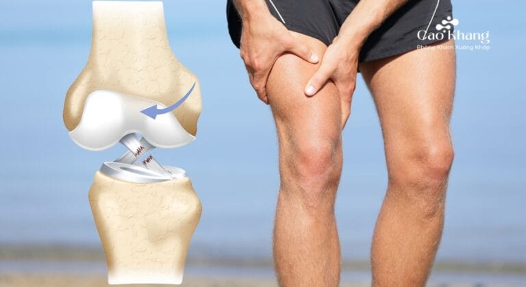 đứt dây chằng chéo trước