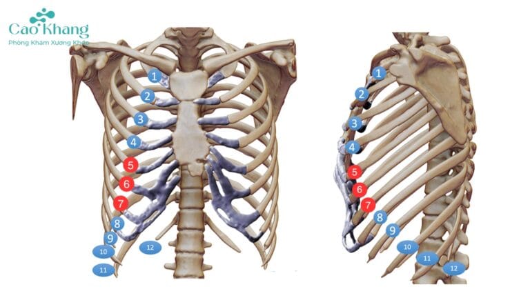 gãy xương sườn số 5 6 7