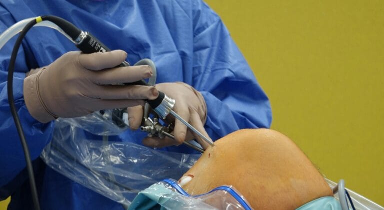 mổ dây chằng chéo trước bao lâu thì hết sưng