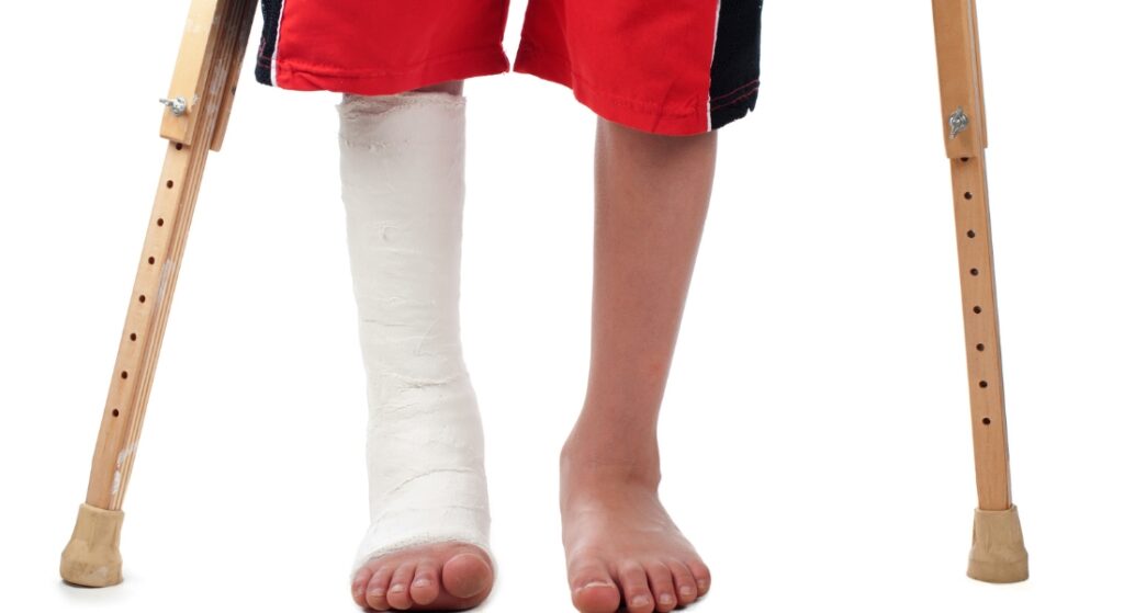 nguyên nhân gãy xương thường gặp ở trẻ em
