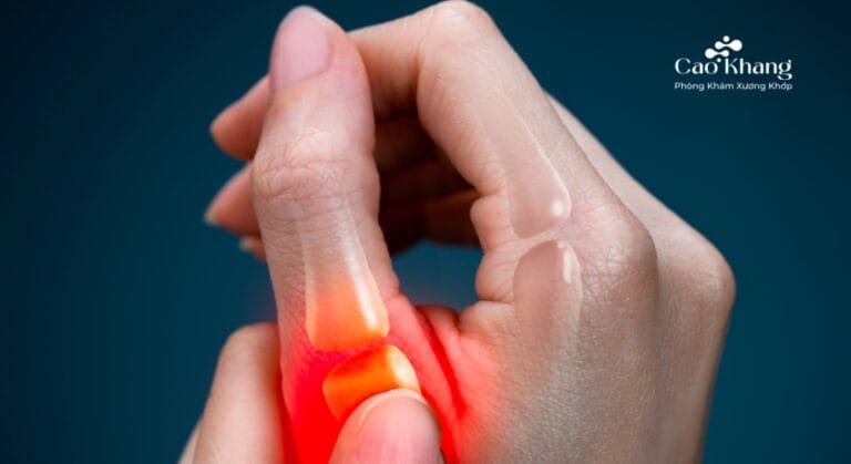 trật khớp ngón tay cái