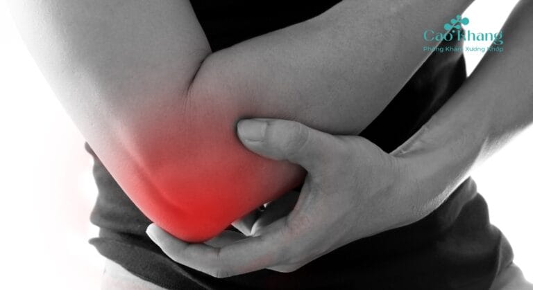 triệu chứng giãn dây chằng khuỷu tay