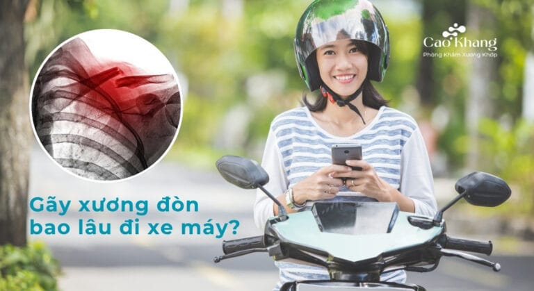 Gãy xương đòn bao lâu đi xe máy