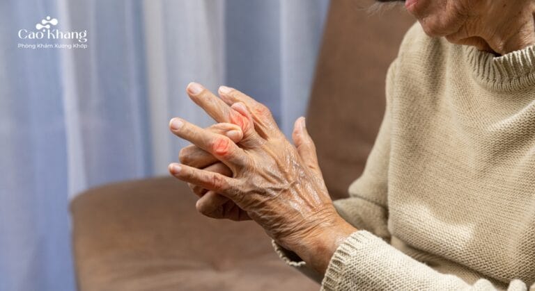 bệnh gút có nguy hiểm đến tính mạng không