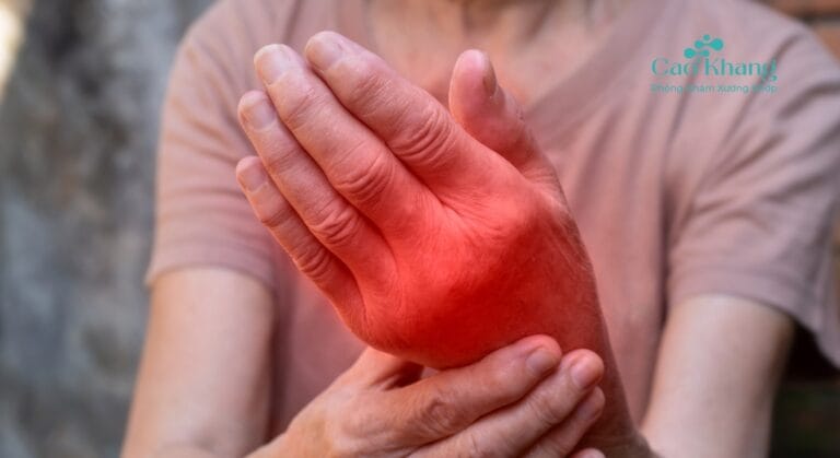 chỗ gãy xương bị sưng