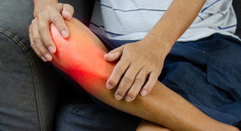 đau nhứt chỗ gãy xương