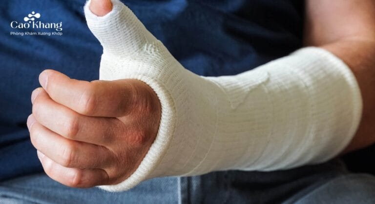 gãy đầu dưới xương quay bó bột bao lâu