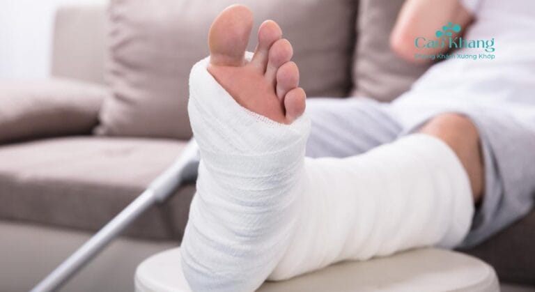gãy xương bàn chân số 5 bó bột bao lâu
