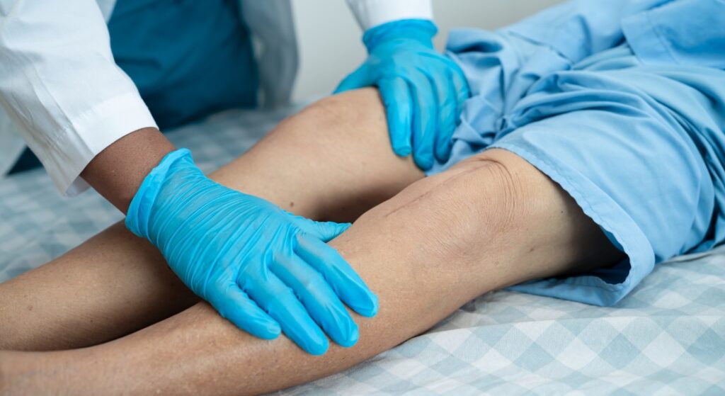 thoái hóa khớp gối có chữa khỏi hoàn toàn không