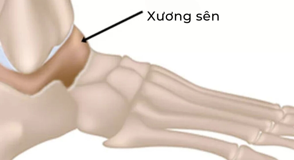 xương sên