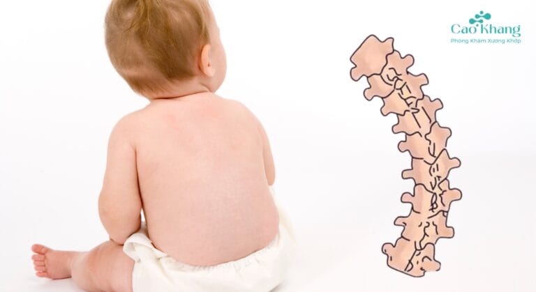 cho trẻ tập ngồi sớm có bị gù lưng không_