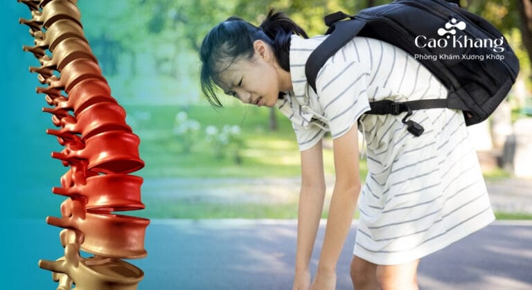 cong vẹo cột sống hoc đường