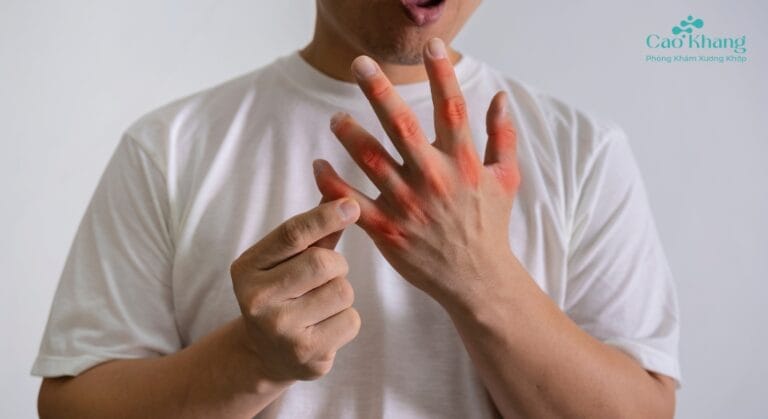 giai đoạn đầu của bệnh gút