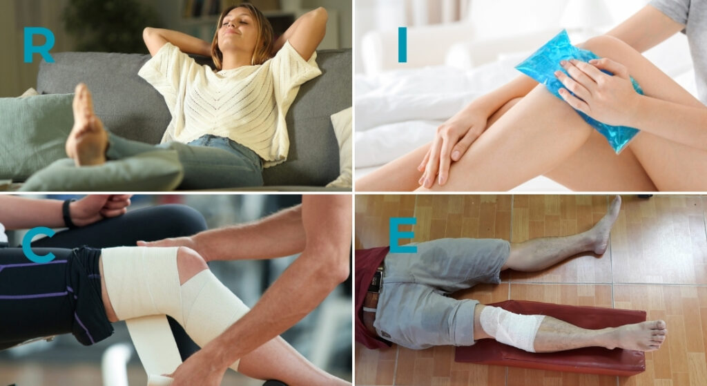 áp dụng phương pháp R-I-C-E khi bị căng cơ