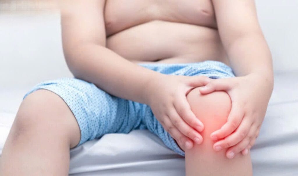 cân nặng ảnh hưởng cơ xương khớp