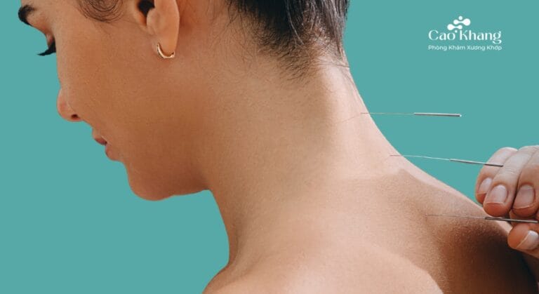 châm cứu cổ vai gáy