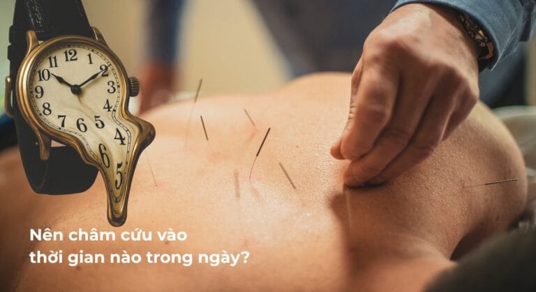 châm cứu vào thời gian nào