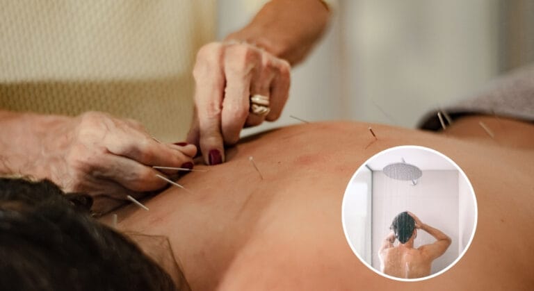 châm cứu xong có tắm được không