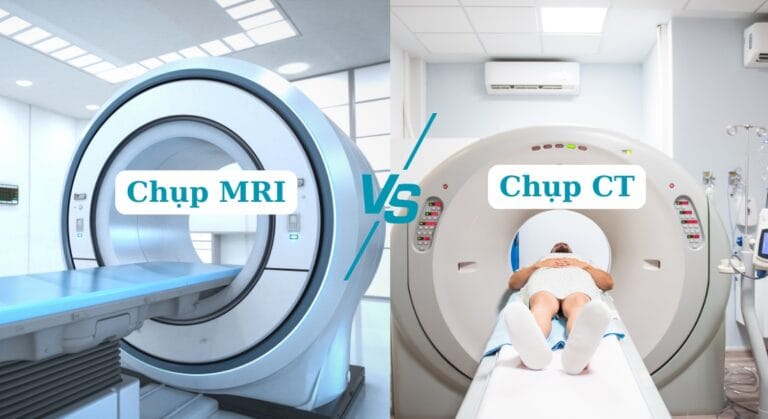 chụp CT và chụp MRI