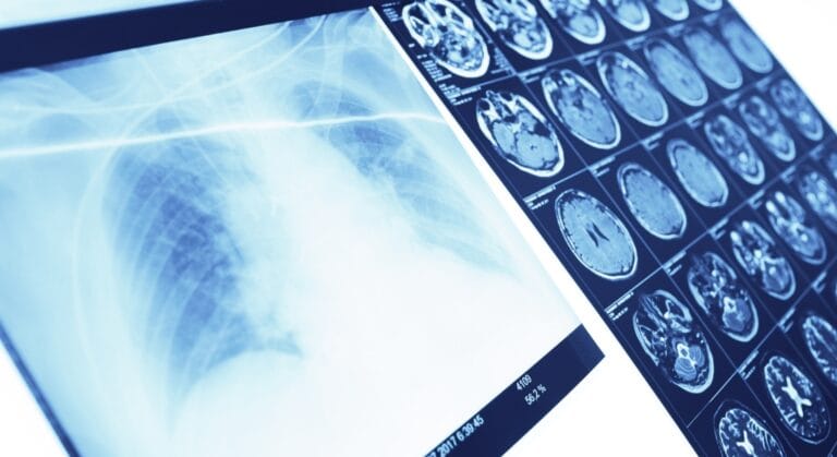 chụp MRI bao lâu có kết quả