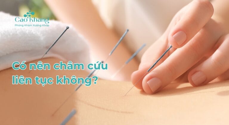 có nên châm cứu liên tục không