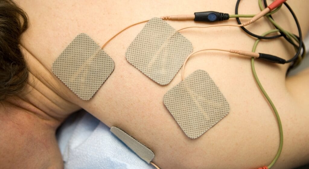 điện trị liệu cổ vai gáy