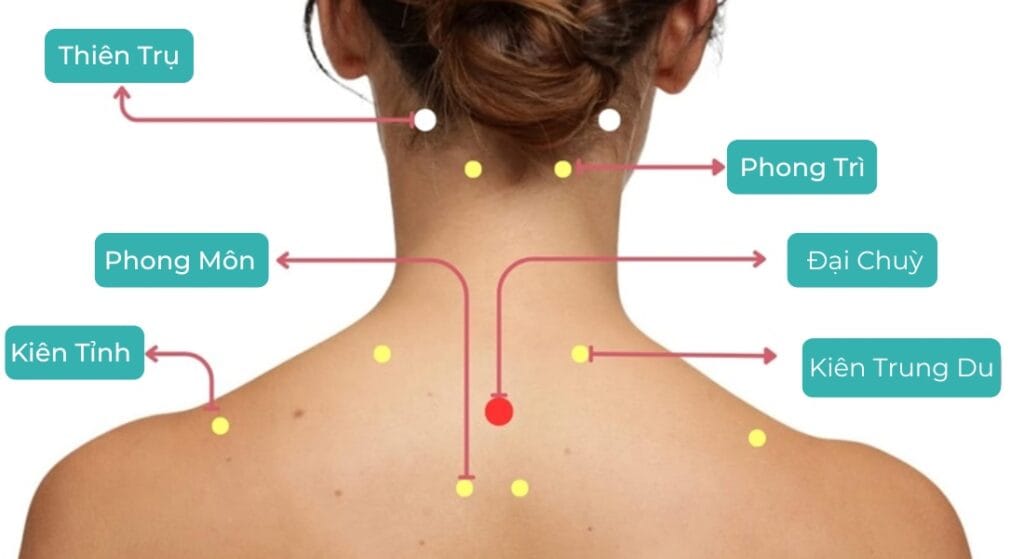 huyệt châm cứu cổ vai gáy