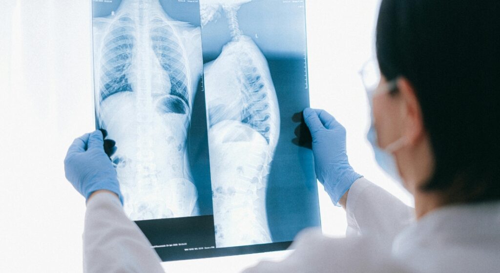 kết quả film chụp MRI