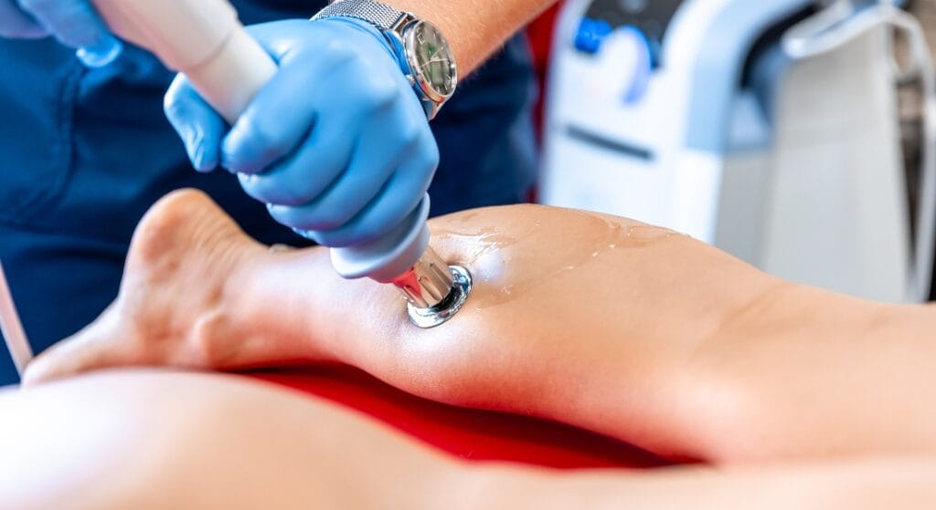 quy trình điều trị sóng xung kích