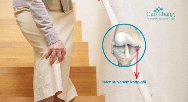 rách sụn chêm khớp gối