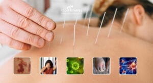 tai biến của châm cứu