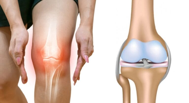 tái tạo sụn khớp