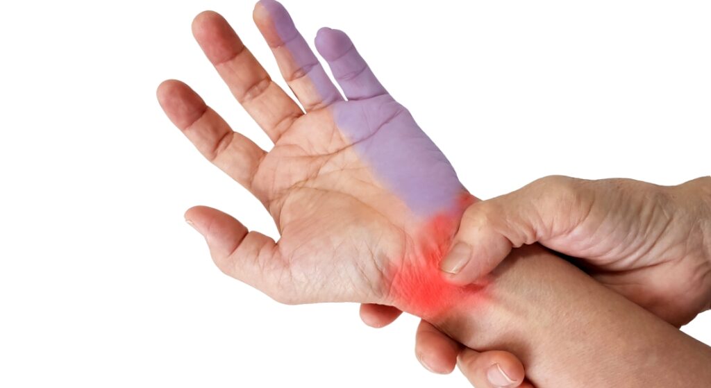 triệu chứng hội chứng kênh Guyon