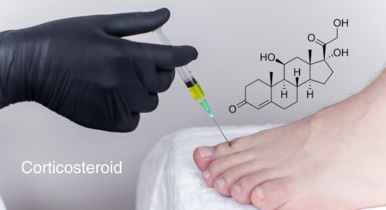 Corticosteroid là gì