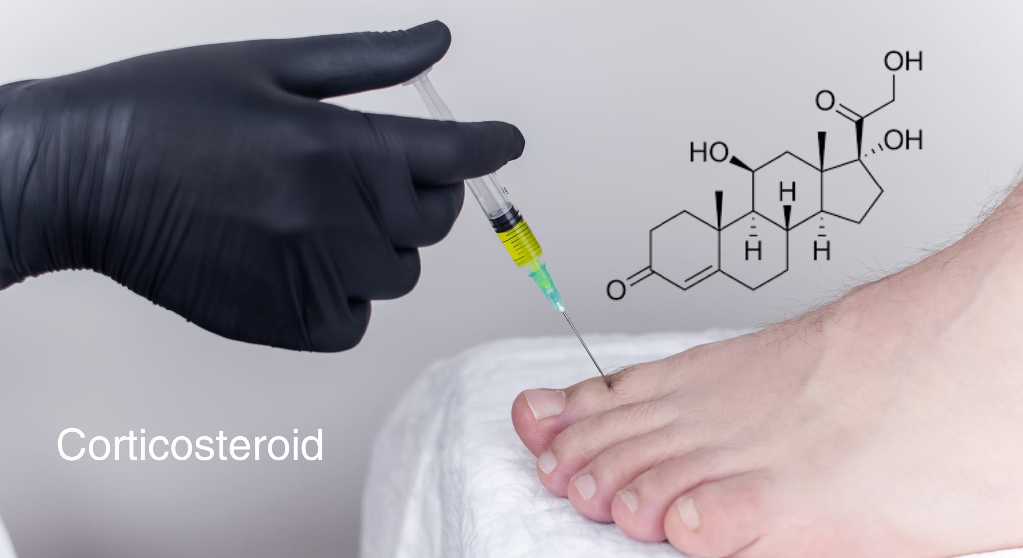 Corticosteroid là gì