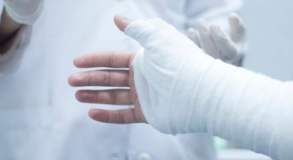 bác sĩ bó bột tay