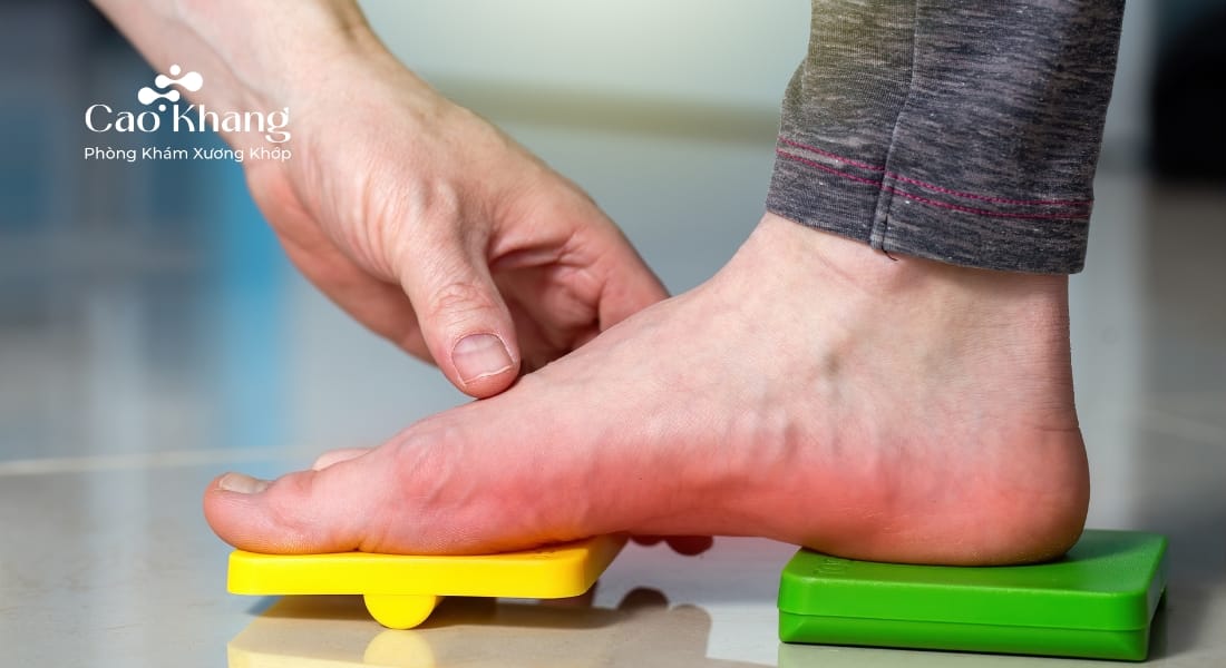 bàn chân bẹt ở người lớn