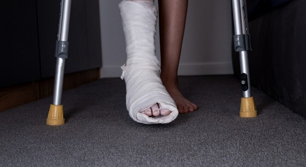 bó bột chân có đi lại được không