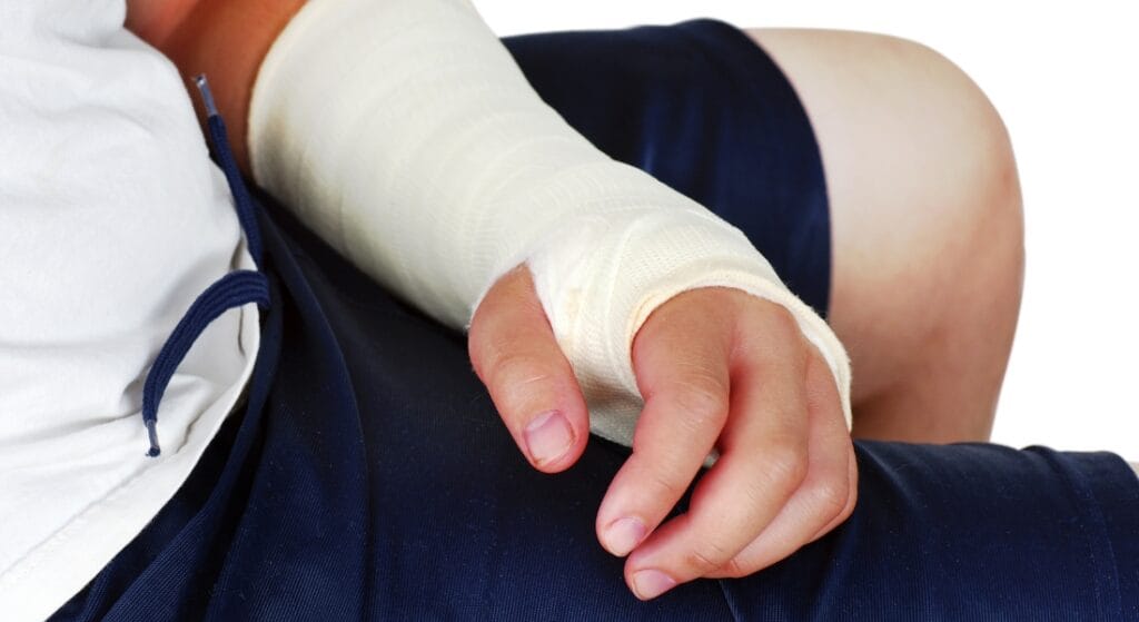 cách ngủ khi bó bột tay