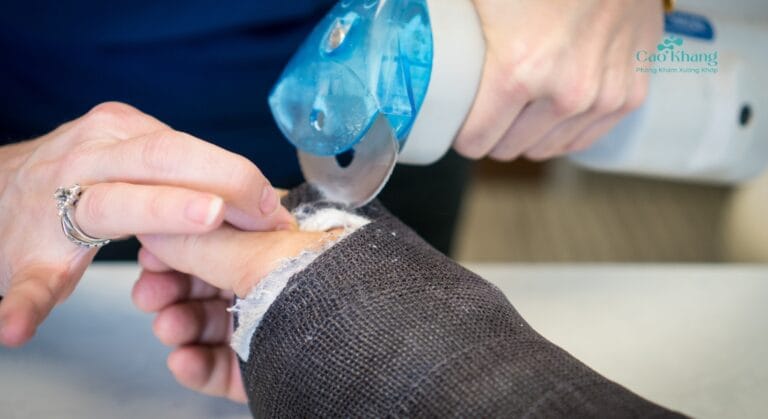 cứng khớp cổ tay sau bó bột