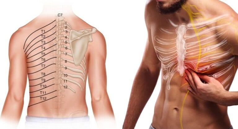 đau dây thần kinh liên sườn