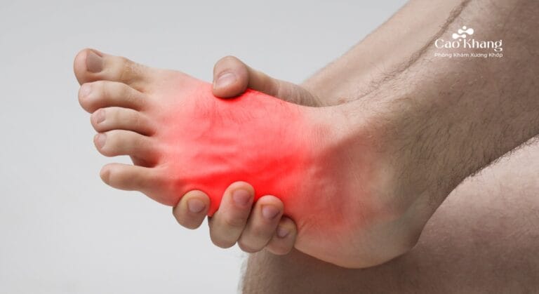 đau mu bàn chân