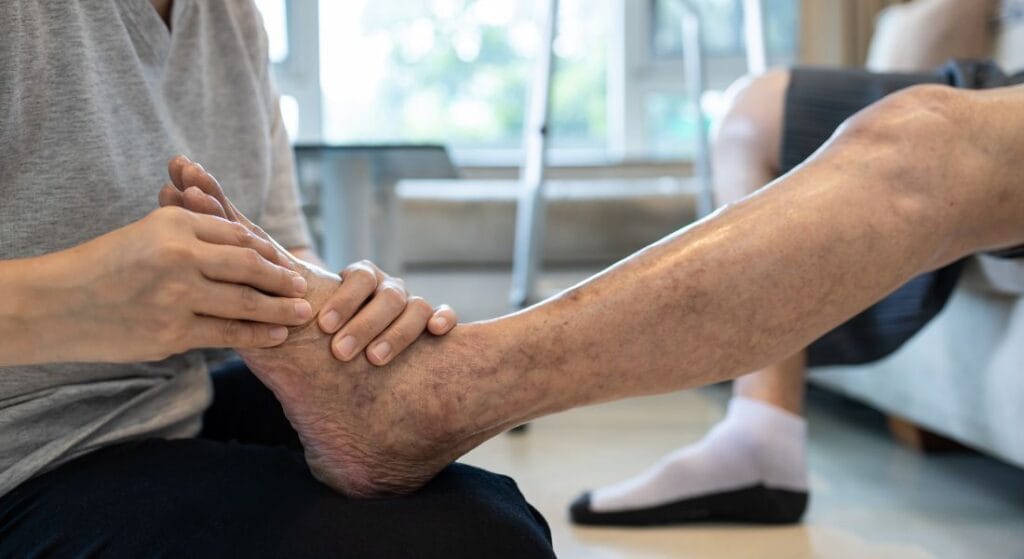 điều trị co rút cơ