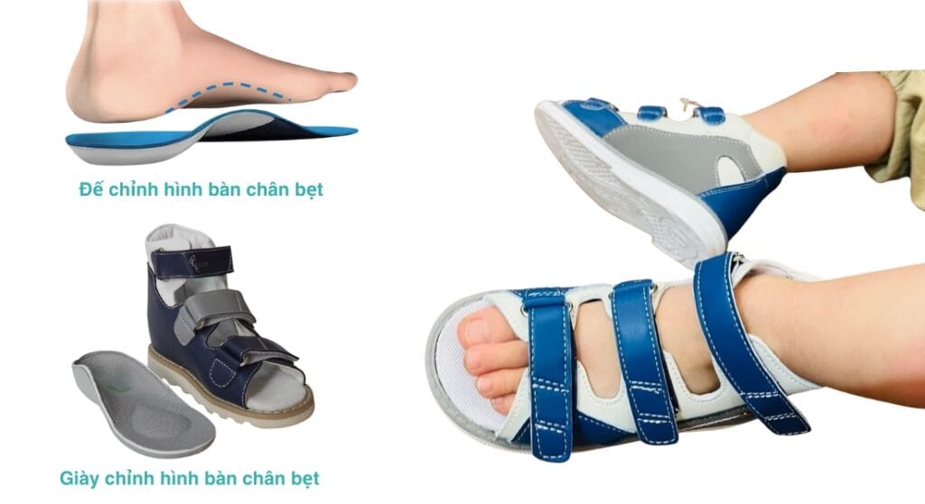 giày chỉnh hình bàn chân bẹt