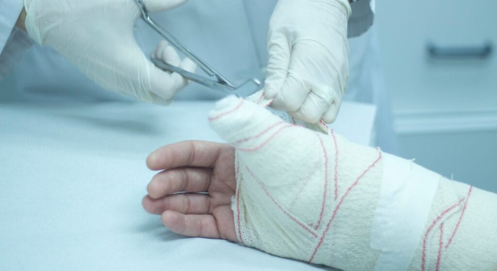 ngứa khi bó bột